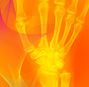 Flexible Ergonomics: Can a Flexible Mouse Fix That Wrist Pain?